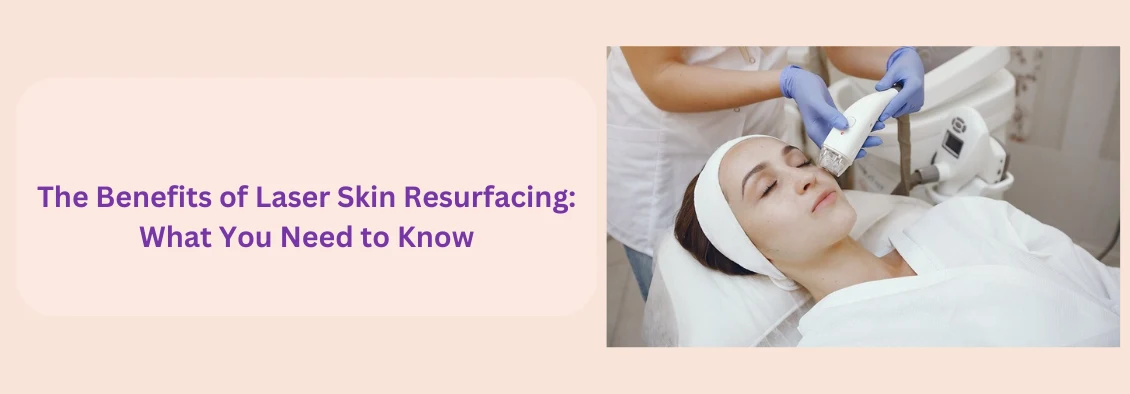 Benefits of Laser Skin Resurfacing